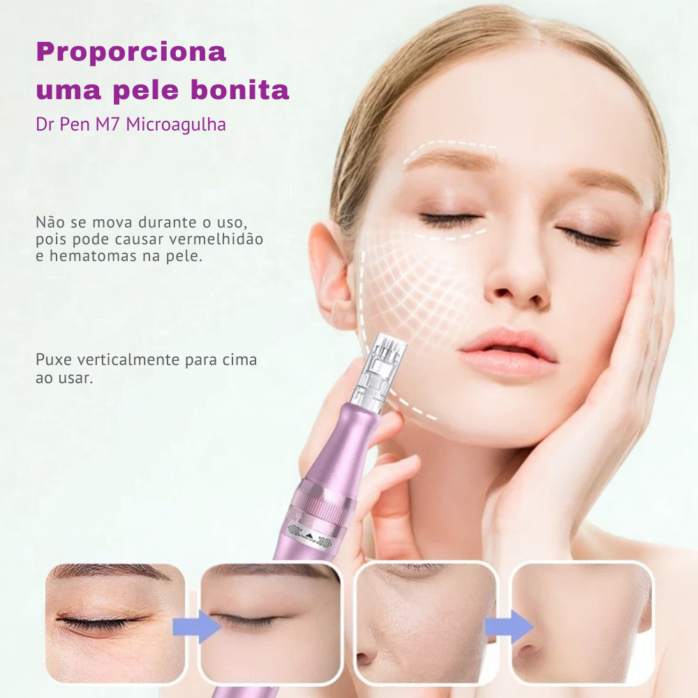 Dr. Pen Para tratamento de Cicatrizes e Manchas na Pele